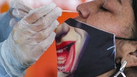 Copper giant Codelco records 3215 coronavirus cases among staff